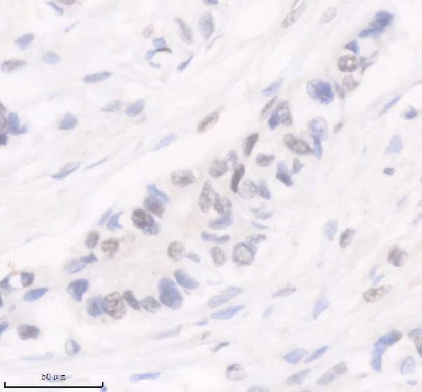 IHC analysis of P-POLR2A using anti-P-POLR2A antibody (P01029-1)