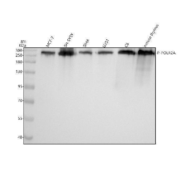 Western blot analysis of P-POLR2A using anti-P-POLR2A antibody (P01029-1)
