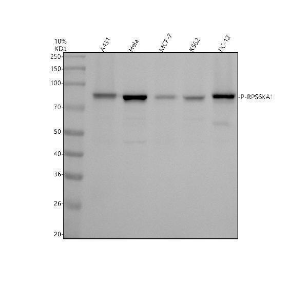 Western blot analysis of P-RPS6KA1 using anti-P-RPS6KA1 antibody (P01058-1)