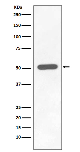 Western blot analysis of Phospho-Chk1 (S296) expression in HEK293 cell lysate Treated with Calyculin