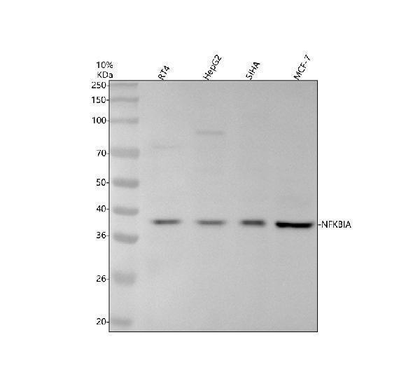 Western blot analysis of IkB Alpha/NFKBIA (Phospho-S36) using anti-IkB Alpha/NFKBIA (Phospho-S36) antibody (P01139-1)
