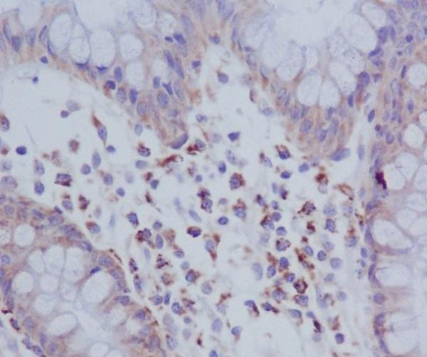 Immunohistochemical analysis of paraffin-embedded human colon, using Phospho-PKR (T446) Antibody
