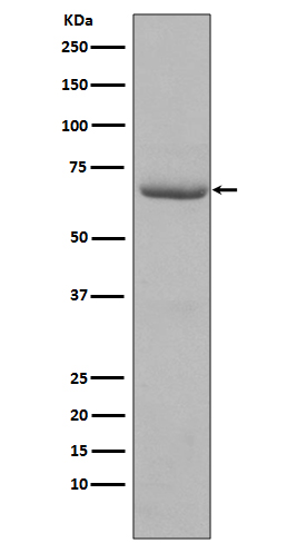 Western blot analysis of PKR phosphorylation expression in HeLa cell lysate treated with Calyculin A and TNF-alpha