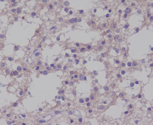 Immunohistochemical analysis of paraffin-embedded mouse brain cancer, using Phospho-TrkB (Y817) Antibody