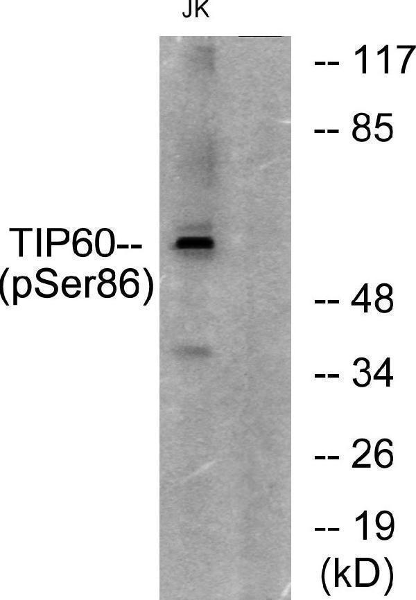 Western blot analysis of lysates from Jurkat cells, using TIP60 (Phospho-Ser86) Antibody