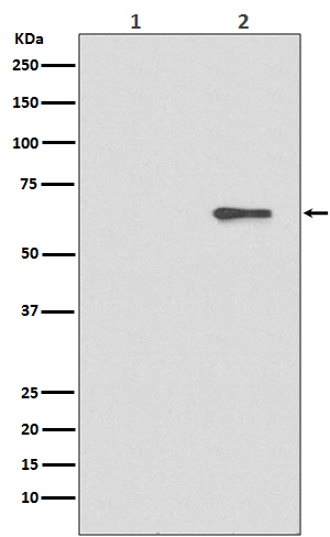 Anti-Phospho-AMPK alpha 2 (S491) PRKAA2 Rabbit Monoclonal Antibody Anti-Phospho-AMPK alpha 2 (S491) PRKAA2 Rabbit Monoclonal Antibody