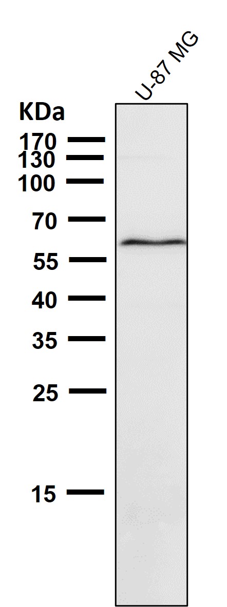 Western blot analysis of AMPK beta 1 expression in (1) 293T cell lysate treated with Lambda lysate; (2) 293T cell lysate. Western blot analysis of AMPK beta 1 expression in (1) 293T cell lysate treated with Lambda lysate; (2) 293T cell lysate.