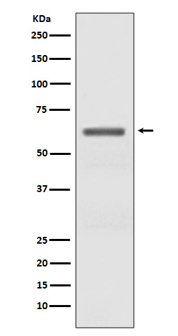 Western blot analysis of Phospho-AMPK alpha (T172) expression in Mouse heart lysate