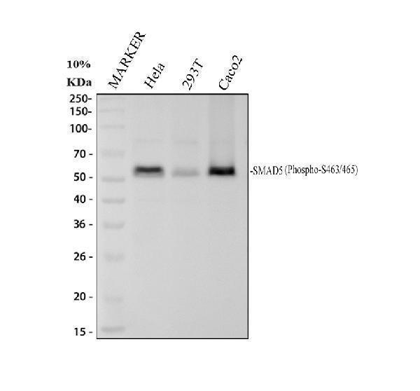 Western blot analysis of Phospho-Smad5 (S463/465) using anti-Phospho-Smad5 (S463/465) antibody (P01423-1)