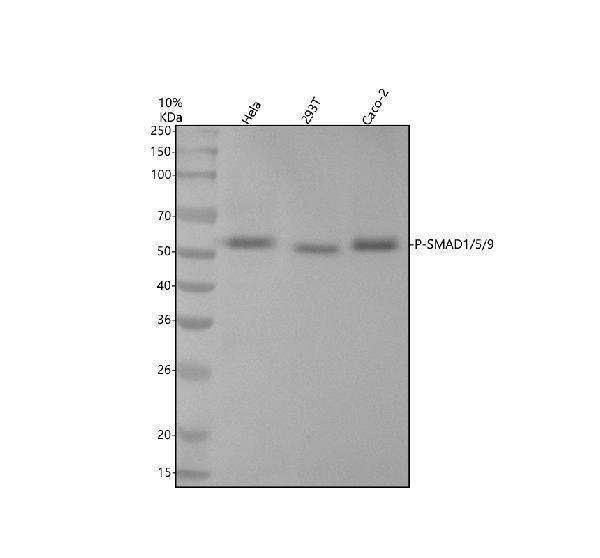 Western blot analysis of P-SMAD1/5/9 using anti-P-SMAD1/5/9 antibody (P01423)