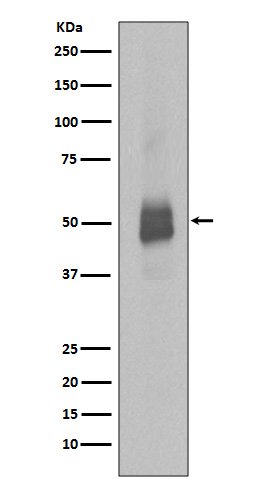 Western blot analysis of Lyn phosphorylation expression in Jurkat cell lysate treated with Pervanadate