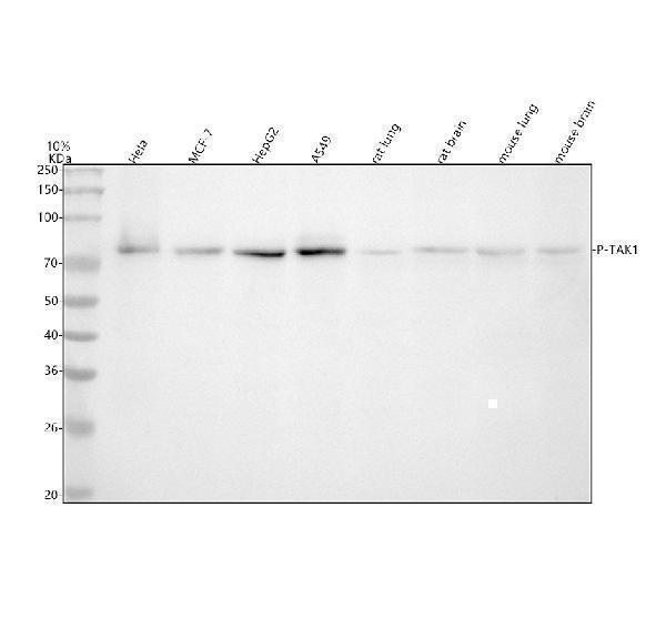  Western blot analysis of Phospho-TAK1 using anti-Phospho-TAK1 antibody (P01458)