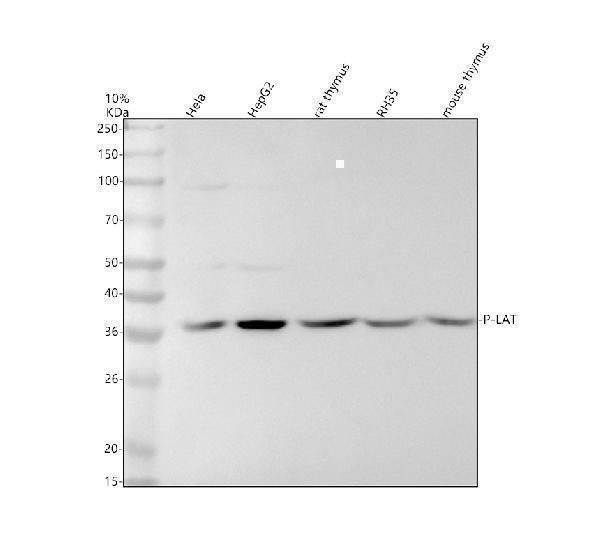 Western blot analysis of P-LAT using anti-P-LAT antibody (P01654)