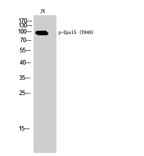 Western Blot analysis of JK cells using Phospho-Eps15 (Y849) Polyclonal Antibody