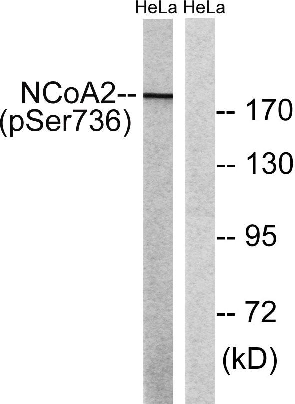 Western blot analysis of lysates from HeLa cells treated with TSA 400nM 24H, using NCoA2 (Phospho-Ser736) Antibody