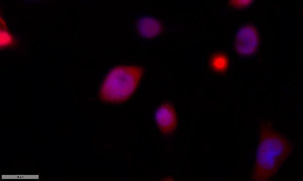 Immunofluorescence analysis of MCF7 cell