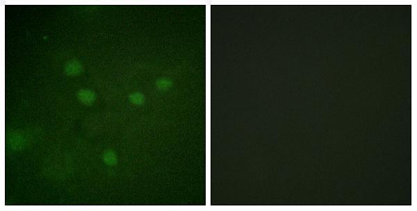 Immunofluorescence analysis of COS7 cells, using NFAT5 (Phospho-Ser1197) Antibody