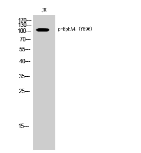 Western Blot analysis of JK cells using Phospho-EphA4 (Y596) Polyclonal Antibody