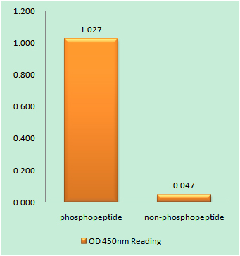 p01992 eif2ak3 primary antibodies elisa testing 1
