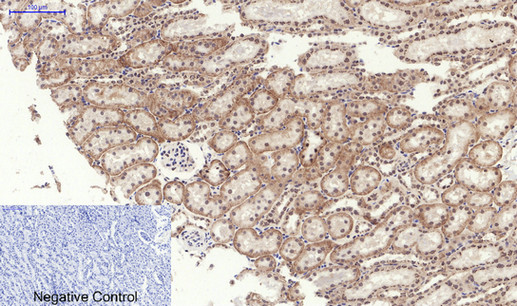 p01992 eif2ak3 primary antibodies if testing 7