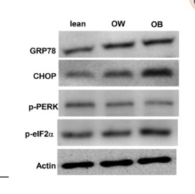 p01992 eif2ak3 primary antibodies ihc testing 3