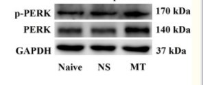 p01992 eif2ak3 primary antibodies ihc testing 4