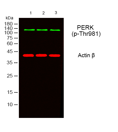 p01992 eif2ak3 primary antibodies ihc testing 5