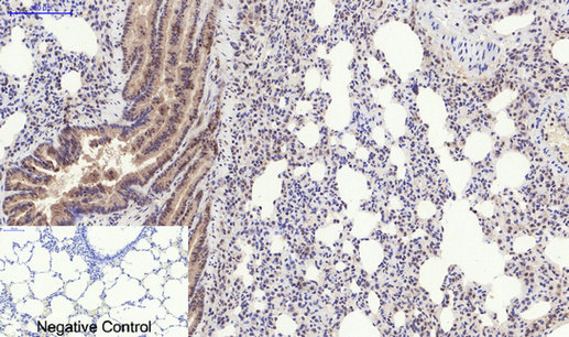 p01992 eif2ak3 primary antibodies ihc testing 6