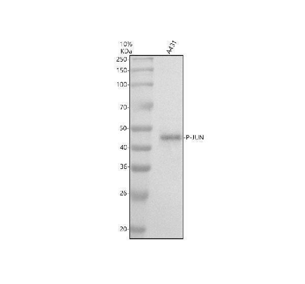 Western blot analysis of P-JUN using anti-P-JUN antibody (P02038-1)