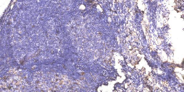 p02067 rpa2 primary antibodies ihc testing 1