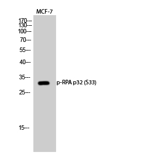 p02067 rpa2 primary antibodies wb testing 2