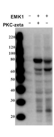 Western Blot of Rabbit anti-MARK2pT595 antibody