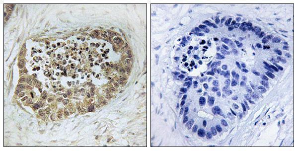 p02148 smc1a primary antibodies ihc testing 1