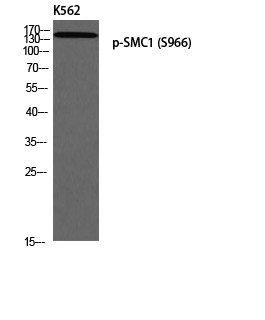 p02148 smc1a primary antibodies wb testing 2