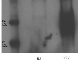 Western Blot and immunoprecipitation of Rabbit anti- IL-7-Receptor-alpha-chain-pY449 antibody