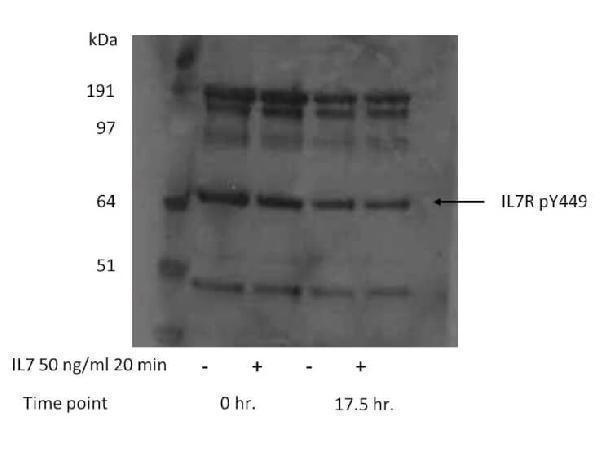Western Blot of Rabbit anti- IL-7-Receptor-alpha-chain-pY449 antibody