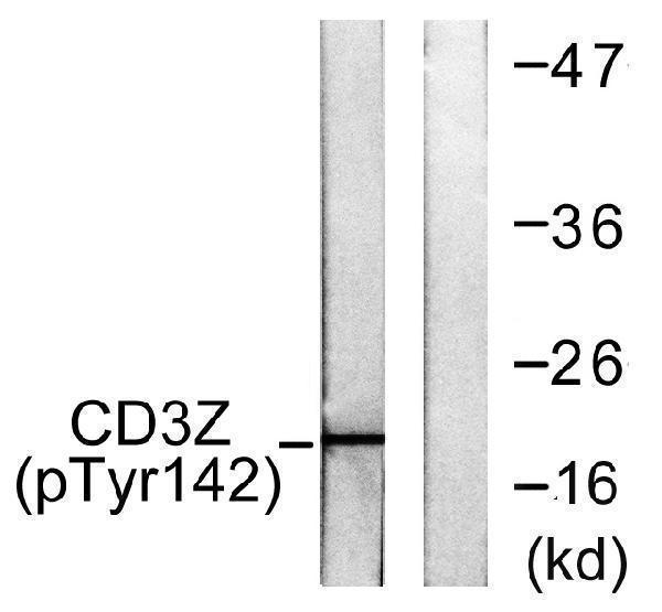 Western blot analysis of lysates from Jurkat cells treated with UV 15