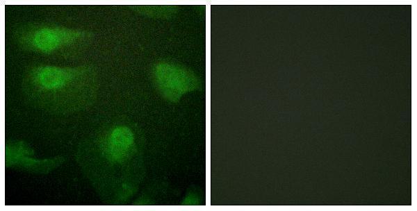 Immunofluorescence analysis of HeLa cells, using CaMK1-alpha (Phospho-Thr177) Antibody