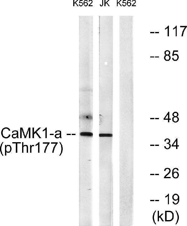 p02576 camk1 primary antibodies wb testing 4