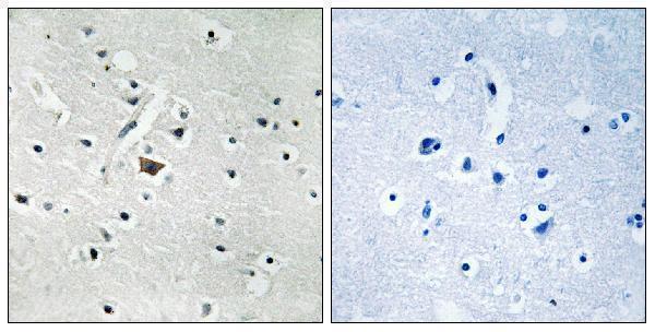 p02586 pld2 primary antibodies ihc testing 2