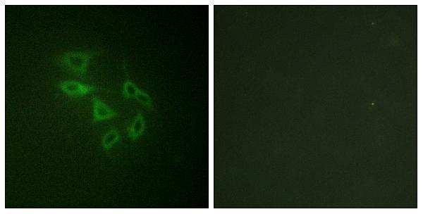 p02638 pikfyve primary antibodies if testing 2