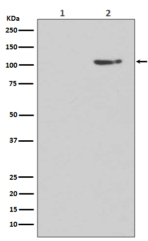 Western blot analysis of Phospho-GluR1 (S845) expression in (1) Human brain lysate treated with Lambda phosphatase lysate; (2) Human brain lysate