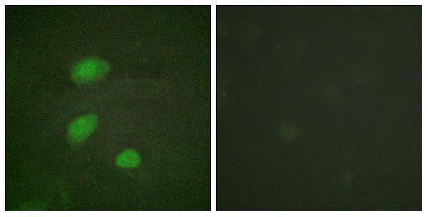 Immunofluorescence analysis of HeLa cells, using HIRA (Phospho-Thr555) Antibody