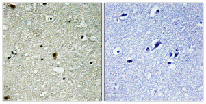 Immunohistochemical analysis of paraffin-embedded Human brain