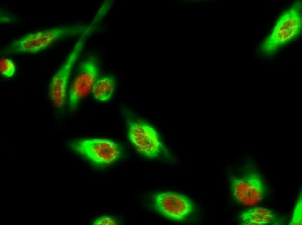 p03300 dapk3 primary antibodies if testing 5