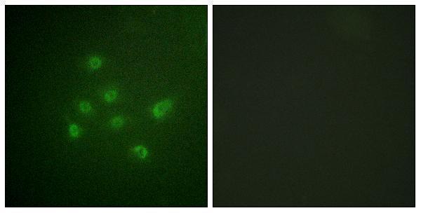 p03300 dapk3 primary antibodies if testing 6