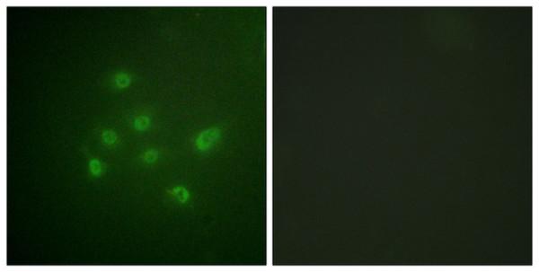 p03300 dapk3 primary antibodies if testing 6_1