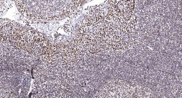 p03300 dapk3 primary antibodies ihc testing 4