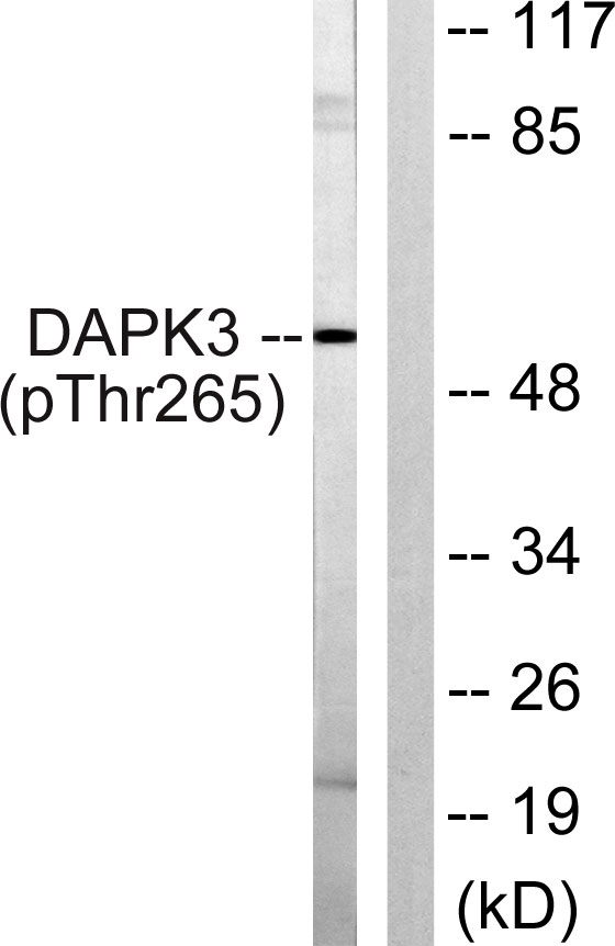 p03300 dapk3 primary antibodies wb testing 3