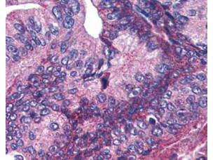 Boster's affinity purified anti-APC1 pS377 antibody was used at 5